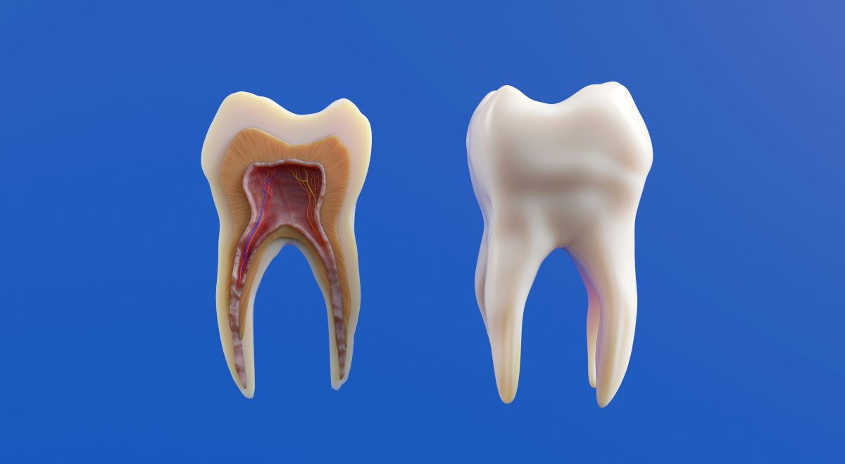 Dental Implant image