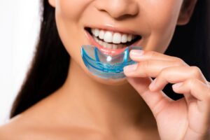 Oral Appliance