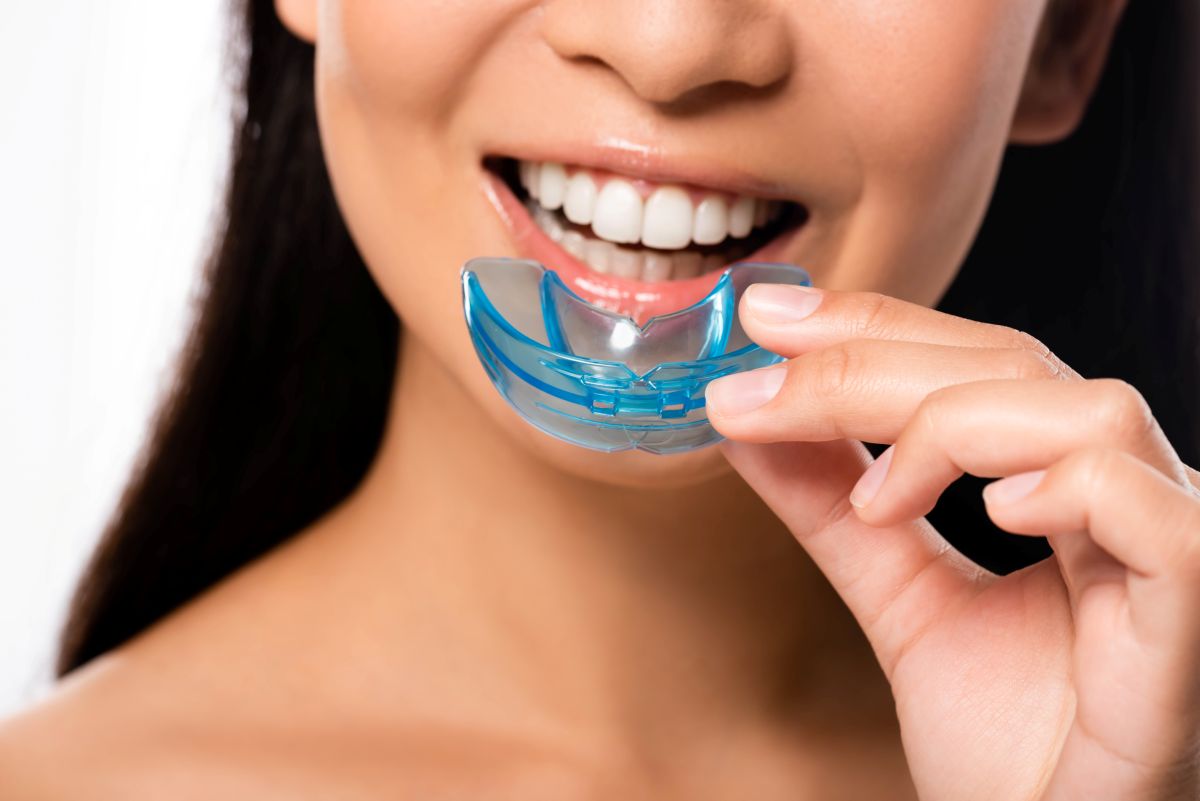 Oral Appliance