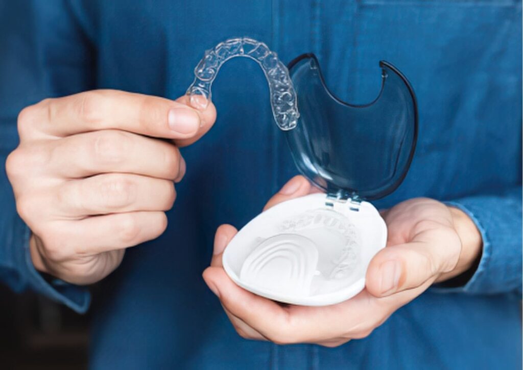 Custom dental nightguard displayed in its storage case to help prevent teeth grinding and nighttime jaw clenching.