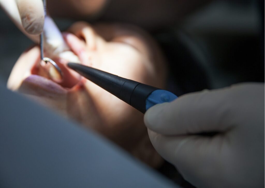 Dentist examining the back of a patient's mouth during an evaluation for an impacted wisdom tooth and possible extraction.